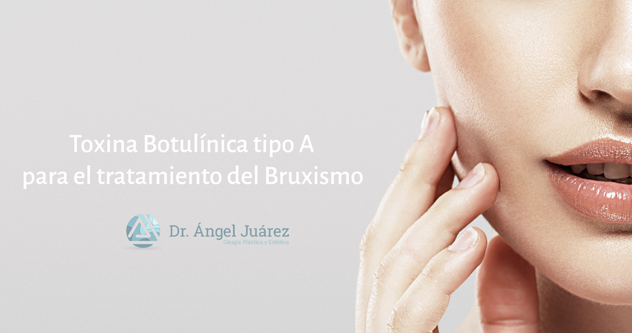 Tratamiento del bruxismo con Toxina Botulínica tipo A - Dr. Ángel Juárez